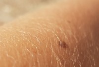 Cette peau artificielle permettrait d'avoir des sensations surhumaines