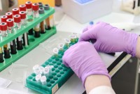 Un deuxième patient atteint du VIH est en rémission (mais on ne sait pas...