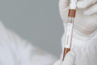 Coronavirus : que faire si vous avez été en contact avec une personne positive ?