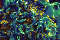 L'ARN messager peut-il servir à développer un vaccin contre le VIH ?