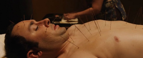 destinationfinale J’ai testé l’acupuncture… et c’est moins l’angoisse que ce que je pensais