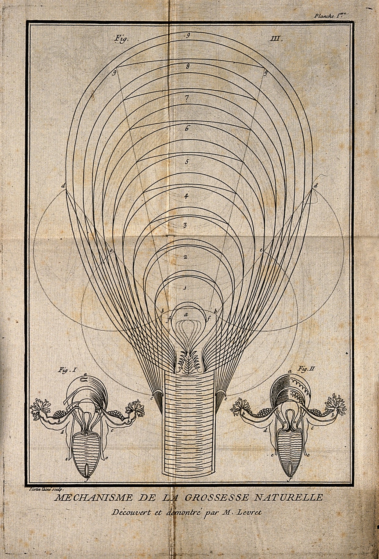 « Trois diagrammes de l’intérieur d’un utérus humain », dans Mécanisme de la grossesse naturelle d’André Levret / Wikipédia, licence CC BY 4.0
