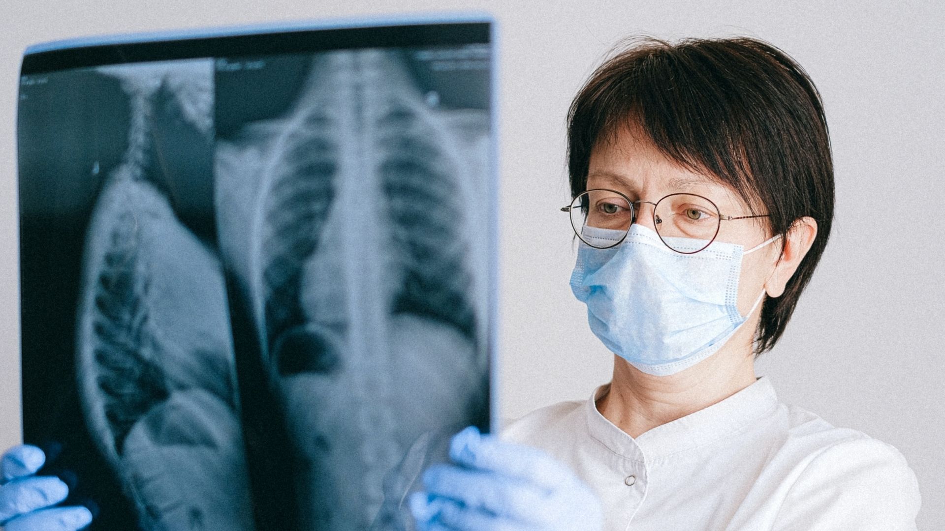 Médecin qui tient une radio